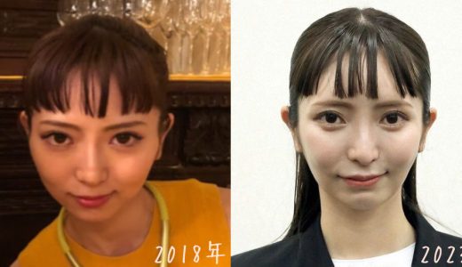 【画像20枚】大津綾香の整形は本当なのか？画像で比較検証！